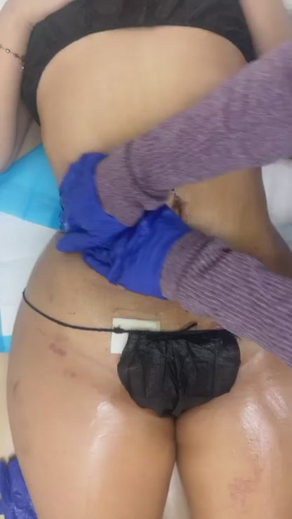 Massage Post Op Care